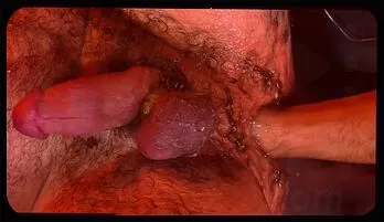 Wolfie Braden Shaw’s Hairy Ass Dominated by Tony Orlando in Intense Fisting Action